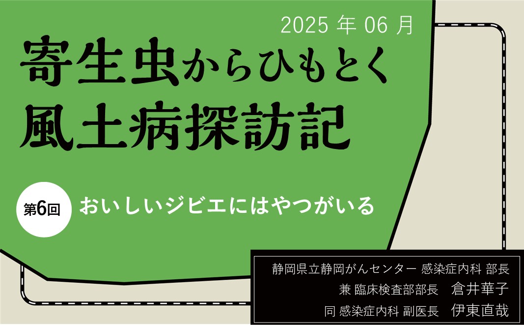 【連載】寄生虫からひもとく風土病探訪記「第6回 おいしいジビエにはやつがいる」 