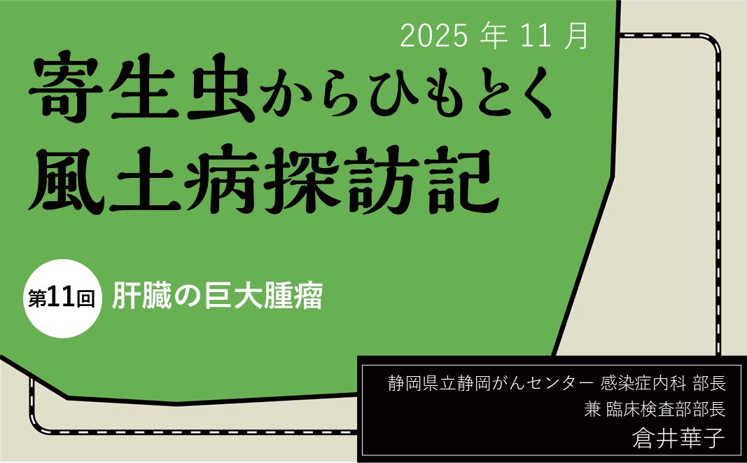 【連載】寄生虫からひもとく風土病探訪記「第11回 肝臓の巨大腫瘤」  