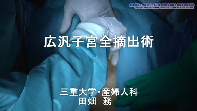 広汎子宮全摘出術｜動画ライブラリ