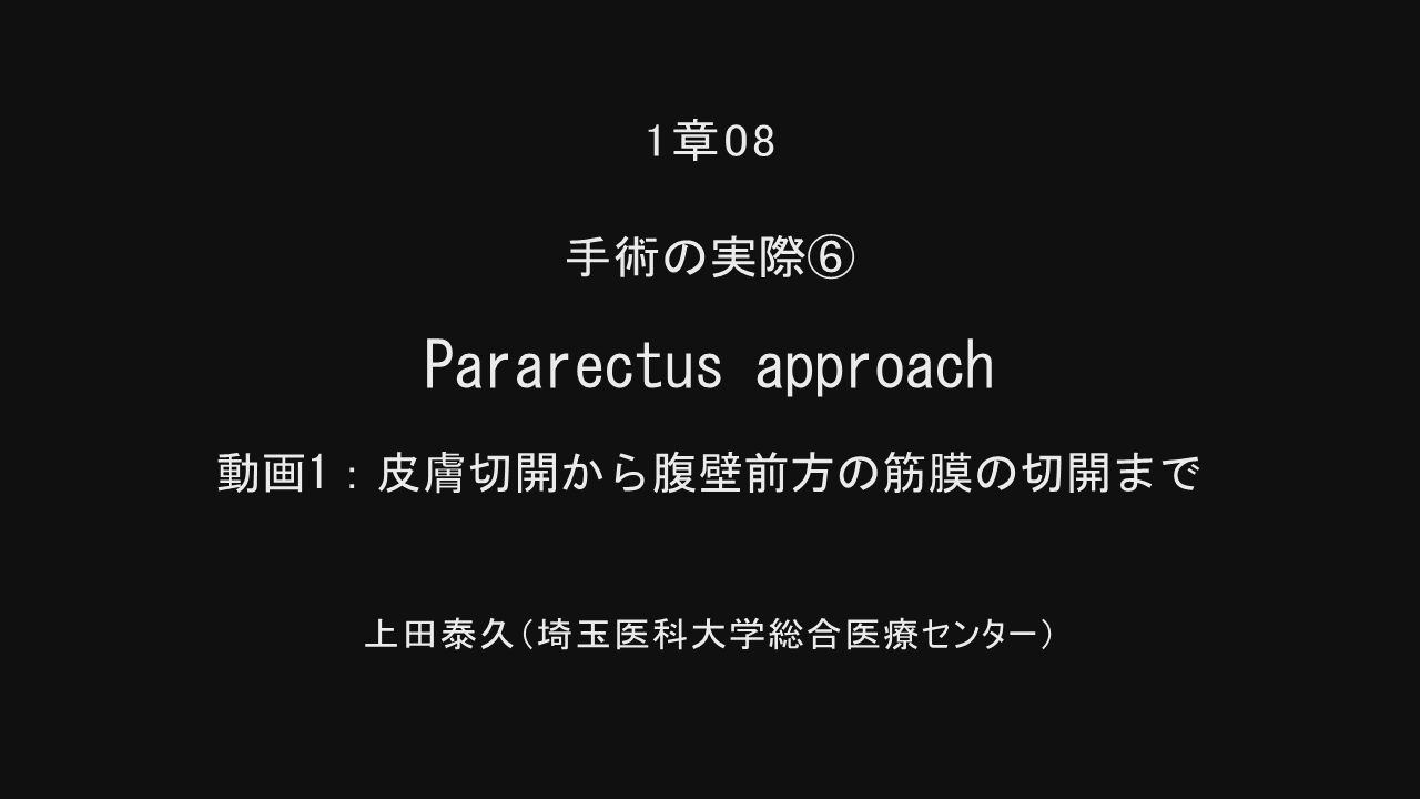 整形外科Surgical Technique BOOKs 9 骨盤骨折 寛骨臼骨折・骨盤輪骨折 