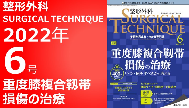 整形外科 SURGICAL TECHNIQUE（整形外科サージカルテクニック）2022年6