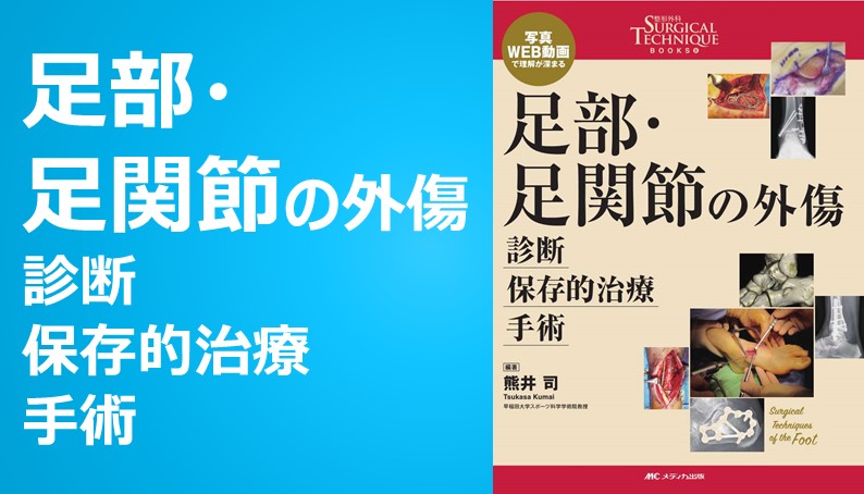 足部・足関節の外傷 診断・保存的治療・手術｜ファイルライブラリ