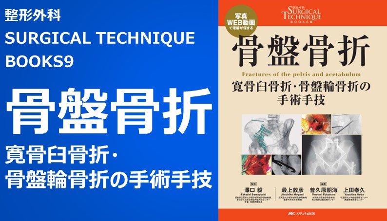 整形外科Surgical Technique BOOKs 9 骨盤骨折 寛骨臼骨折・骨盤輪骨折の手術手技｜動画ライブラリ