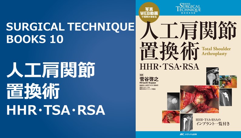 人工肩関節置換術 HHR・TSA・RSA｜動画ライブラリ