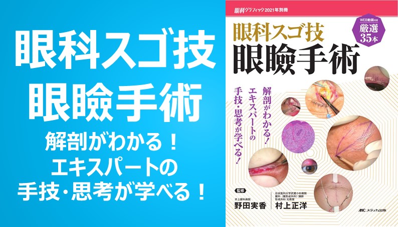 眼瞼手術の極意 裁断済 - 健康・医学