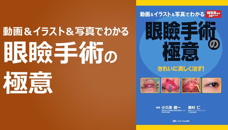 実況動画で「コツ」がわかる！チーム柿﨑の外来眼形成手術｜動画ライブラリ