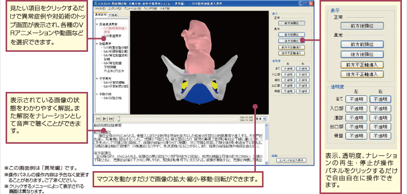 骨系統疾患 : 出生前診断と周産期管理